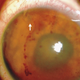Imagen: The New England Journal of Medicine